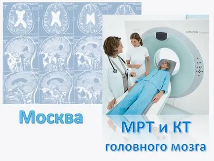 Mi lesz az agyalapi mirigy MRI