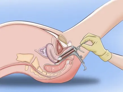 Mi nyaki parakeratosis