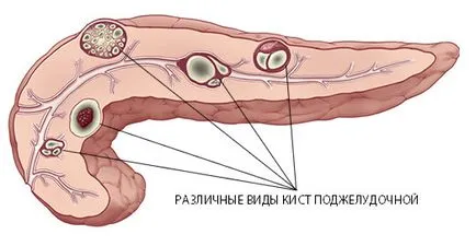 Ctentirovanie на жлъчните пътища, което е, четене, държейки и усложнения