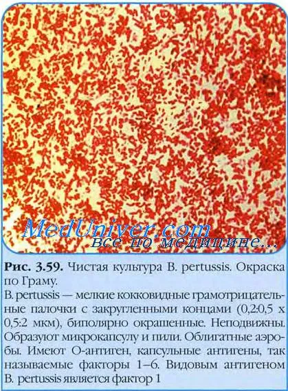 diagnózis pertussis