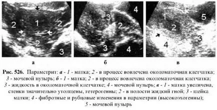 Diagnosztizálása méh betegségek - Uzi