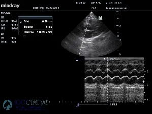 Echo cat szív Moszkva - alacsony áron echokardiográfia Doppler macska - állatorvosi klinikán „zoostatus”