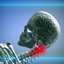 Hipoplazia simptomelor arterei vertebrale, tratament, descriere