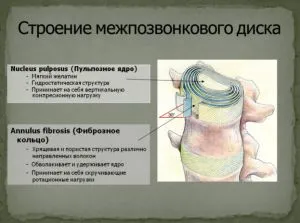 hernia de disc (intervertebral) hernia de disc