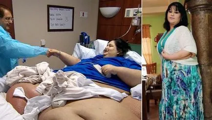 Ahogy a legkövérebb nő lefogyott 2017-ben a fogyás