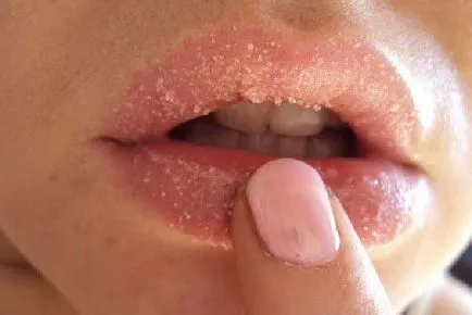 Как да уголемите устните без хирургия и се грижи за тях у дома