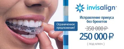 Invisalign aligners или скоби