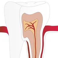 Tratamentul canalelor dentare 1