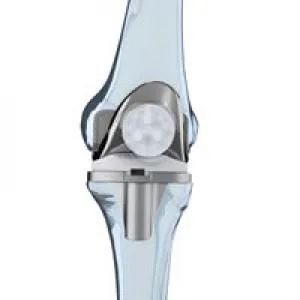 Materiale pentru artroplastia de genunchi - implanturi - Centrul de suport medical