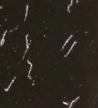 Diagnosticul de sifilis microscopica