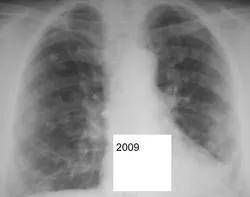 Mts sau orice altceva, portal de radiologi