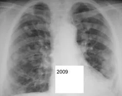 Mts sau orice altceva, portal de radiologi