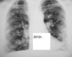 Mts sau orice altceva, portal de radiologi