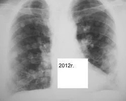 Mts sau orice altceva, portal de radiologi