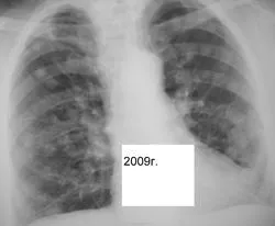 Mts sau orice altceva, portal de radiologi