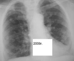 Mts sau orice altceva, portal de radiologi