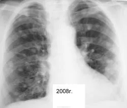 Mts sau orice altceva, portal de radiologi