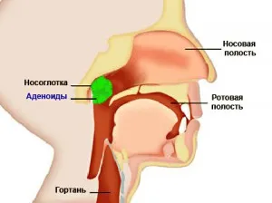 Анестезия за отстраняване на аденоидите при деца и възрастни