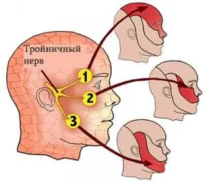 Неврит на лицевия нерв при лечението на 