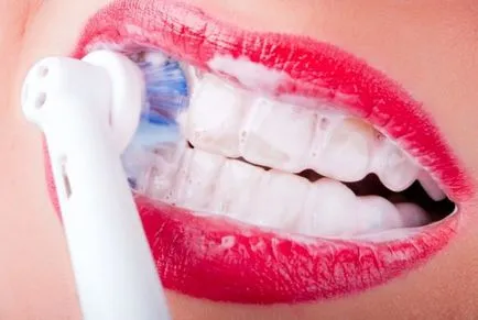 Hogyan válasszuk ki az elektromos fogkefe gyermek és felnőtt