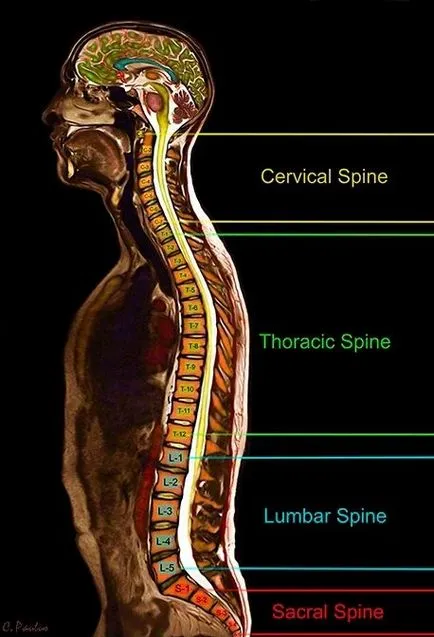 Informații generale privind IRM a coloanei vertebrale