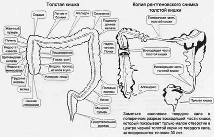 червата лечение - дали е необходимо да почистите червата