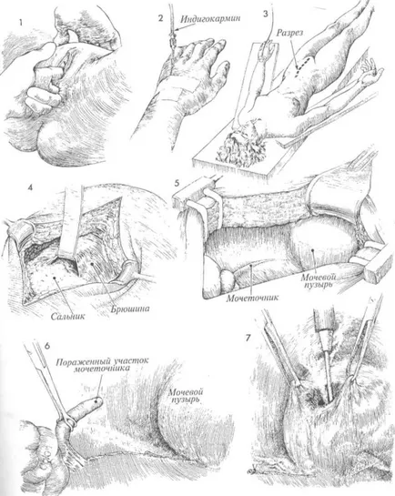 Действието на уретера в трансплантации на пикочния мехур без използването на и