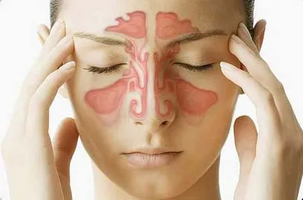 Pansinusitis akut és krónikus - tünetek és a kezelés minden típusú pansinusita