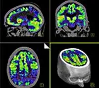 PET-CT az agy - az árak Moszkvában talált 9 árak