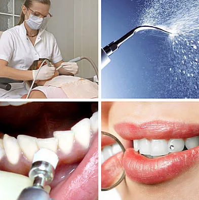 струйно почистване на зъбите - цена, противопоказания, ревюта