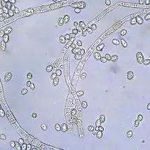 Mould mikroszkóp alatt tudja az ellenség az arcon