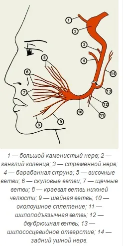 Invinge cotite ganglion - nevralgie Hunt