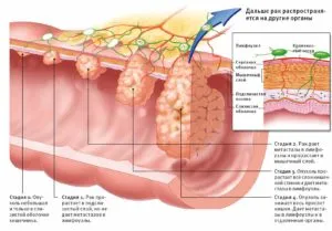 Diaree cu mucus in simptomele adulti, diagnostic