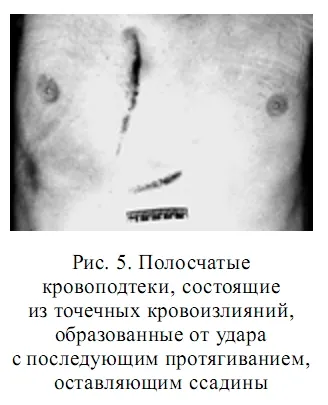 Кожните лезии тъпи травма пистолети