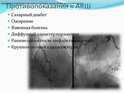 la prezentarea definiției de funcționare ale arterelor coronare shuntirovanie-, care permite restabilirea