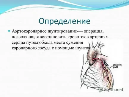 la prezentarea definiției de funcționare ale arterelor coronare shuntirovanie-, care permite restabilirea