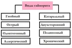 Tratamentul sinuzitei parietal