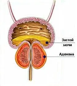 Prostamol лечение Prostamol - полезни статии, съвети