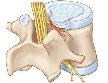 proeminența de disc spinării a simptomelor lombare și tratamente