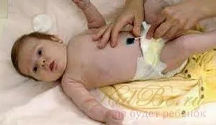 Пъпа новородено