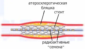 Radionuclizilor în diagnosticul și terapia