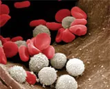 A fejlett microdevice sürgősségi vér tisztítására