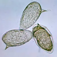 Schistosoma Мънсън (Schistosoma mansoni)