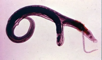 Schis emberekben, tünetei és kezelése, fotó schistosoma