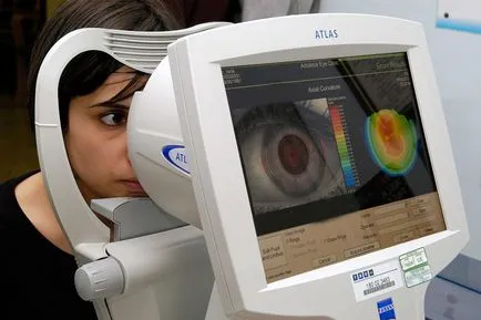 Keratoconus - diagnostic și tratament la centrul Fedorova