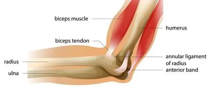 Cot de tenis - simptome, diagnostic și tratament