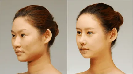 spitale de top face chirurgie plastica din Thailanda