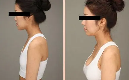 spitale de top face chirurgie plastica din Thailanda