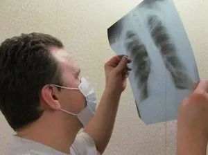 Boala Tuberculoza cum să trateze și cum să evite boala, prevenirea bacteriilor tuberculoza