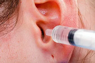 Отстраняването на ушна кал в ухото на водороден пероксид